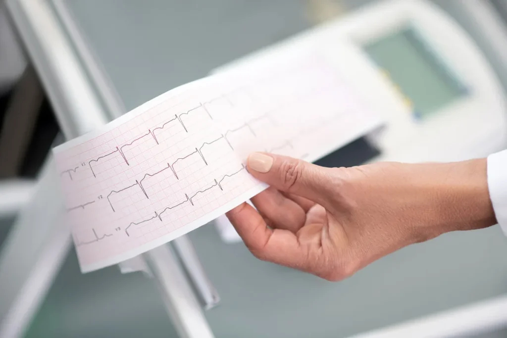 Médica segura o traçado de um eletrocardiograma (ECG) em frente ao eletrocardiógrafo